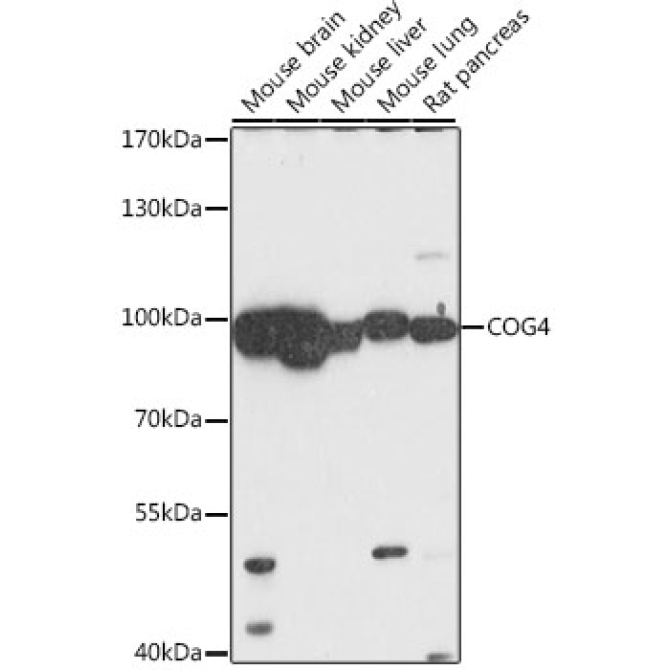 COG4 Rabbit Polyclonal Antibody