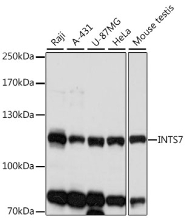 INTS7 Rabbit Polyclonal Antibody