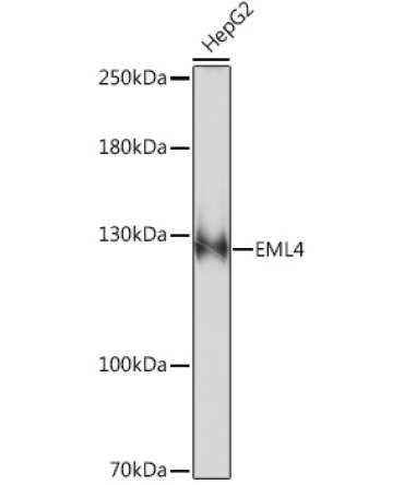 EML4 Rabbit Polyclonal Antibody
