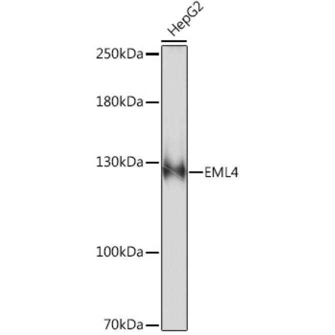 EML4 Rabbit Polyclonal Antibody