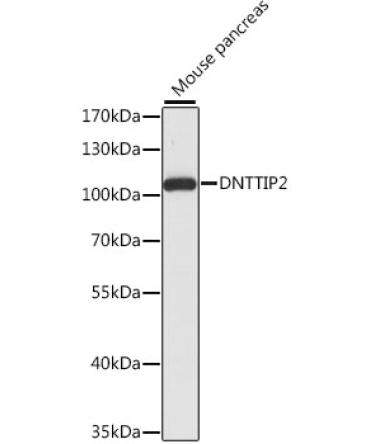 DNTTIP2 Rabbit Polyclonal Antibody