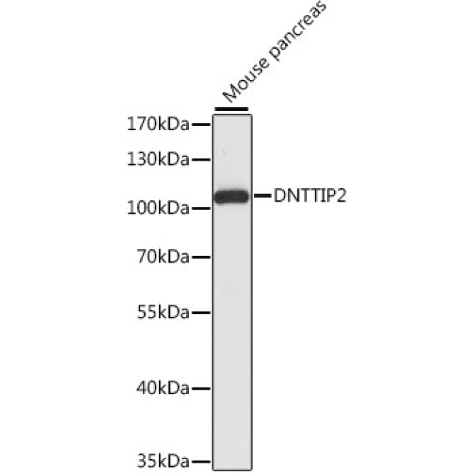 DNTTIP2 Rabbit Polyclonal Antibody