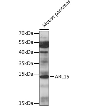 ARL15 Rabbit Polyclonal Antibody
