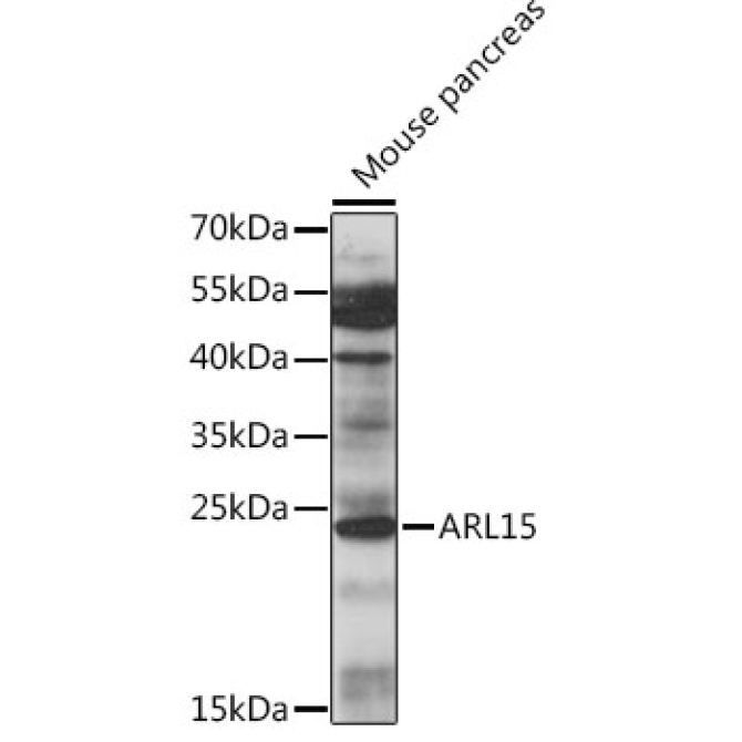 ARL15 Rabbit Polyclonal Antibody