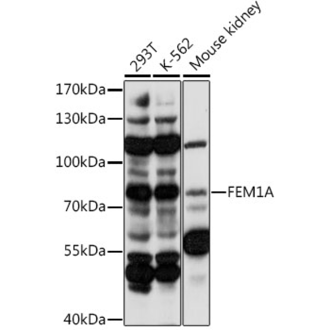 FEM1A Rabbit Polyclonal Antibody