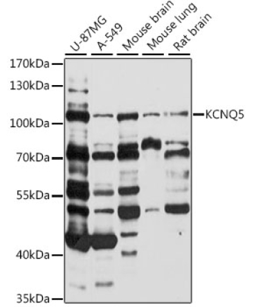KCNQ5 Rabbit Polyclonal Antibody