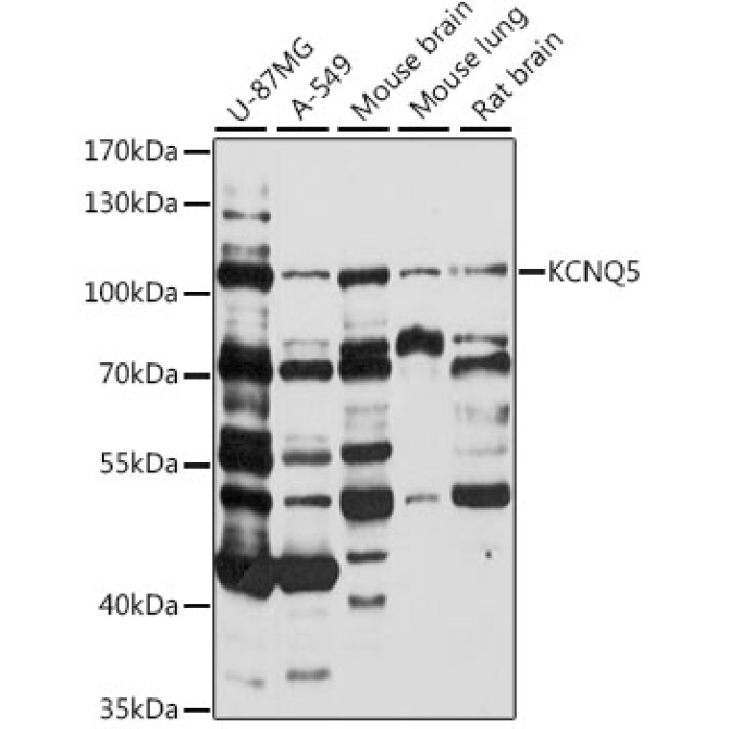 KCNQ5 Rabbit Polyclonal Antibody