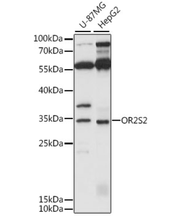OR2S2 Rabbit Polyclonal Antibody