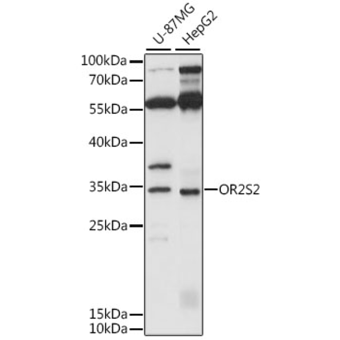 OR2S2 Rabbit Polyclonal Antibody