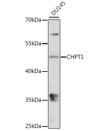 CHPT1 Rabbit Polyclonal Antibody