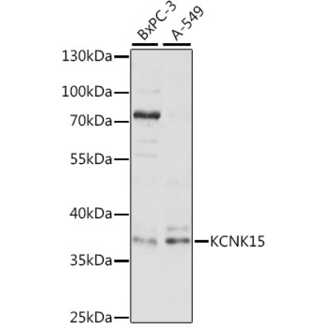 KCNK15 Rabbit Polyclonal Antibody