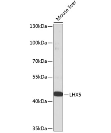 LHX5 Rabbit Polyclonal Antibody