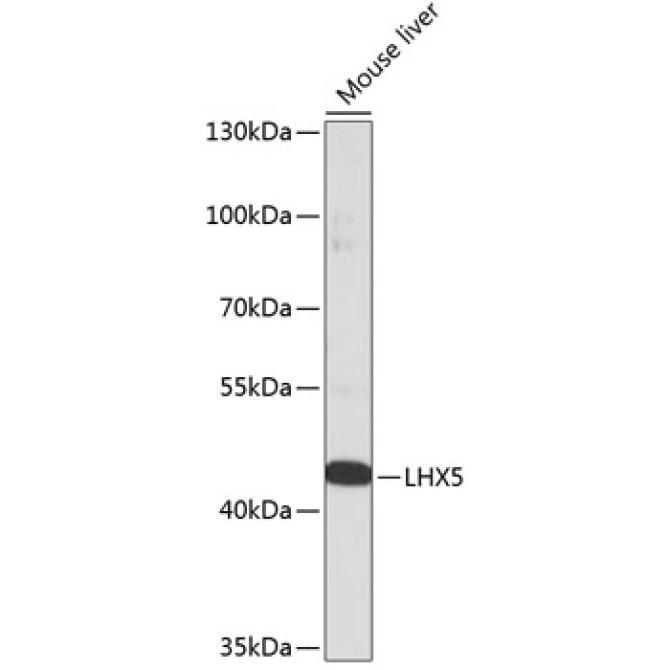 LHX5 Rabbit Polyclonal Antibody