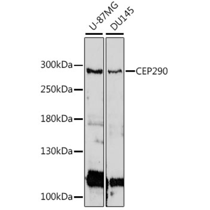 CEP290 Rabbit Polyclonal Antibody