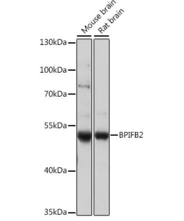 BPIFB2 Rabbit Polyclonal Antibody