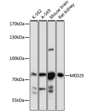 MED25 Rabbit Polyclonal Antibody
