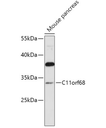 C11orf68 Rabbit Polyclonal Antibody