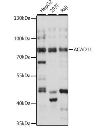 ACAD11 Rabbit Polyclonal Antibody