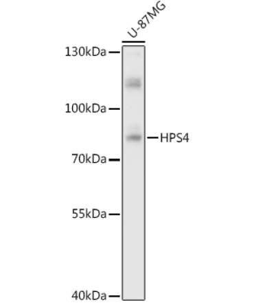 HPS4 Rabbit Polyclonal Antibody