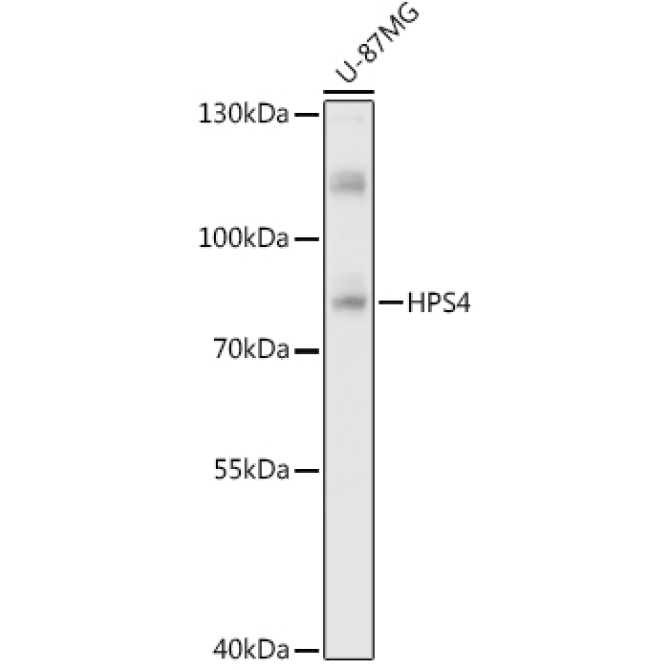HPS4 Rabbit Polyclonal Antibody