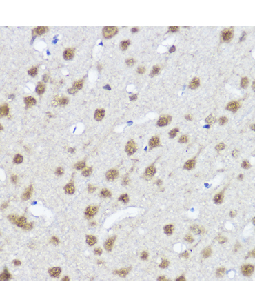 MYOCD Rabbit Polyclonal Antibody