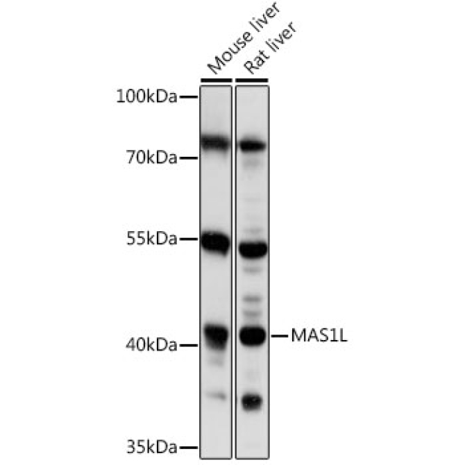 MAS1L Rabbit Polyclonal Antibody