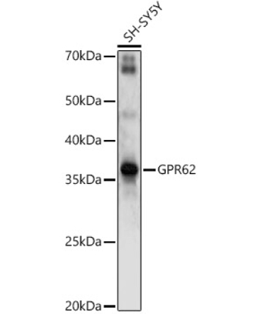 GPR62 Rabbit Polyclonal Antibody