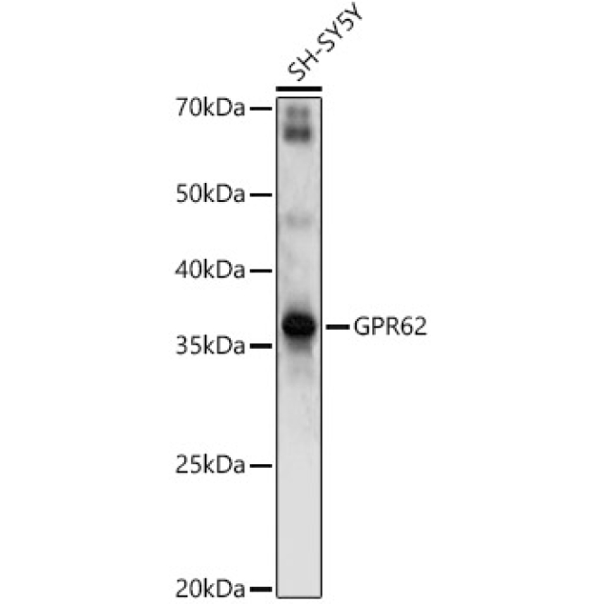GPR62 Rabbit Polyclonal Antibody