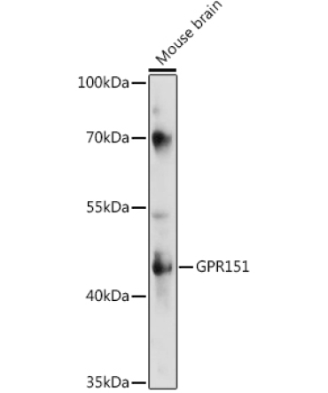 GPR151 Rabbit Polyclonal Antibody
