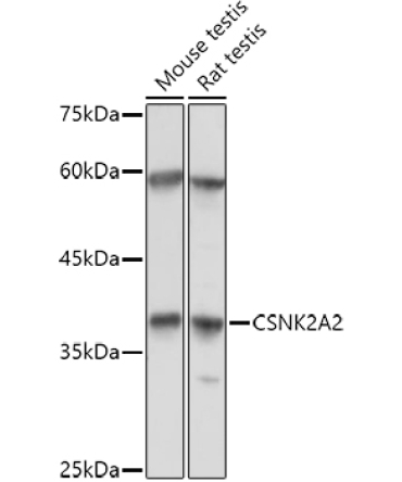 CSNK2A2 Rabbit Polyclonal Antibody