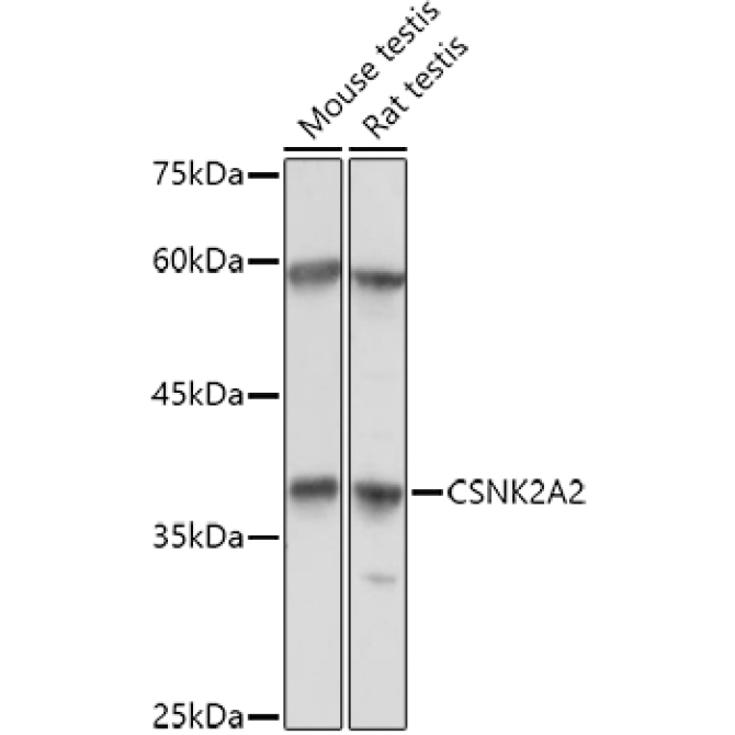 CSNK2A2 Rabbit Polyclonal Antibody