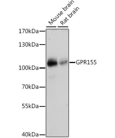 GPR155 Rabbit Polyclonal Antibody