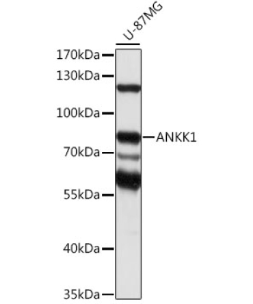 ANKK1 Rabbit Polyclonal Antibody