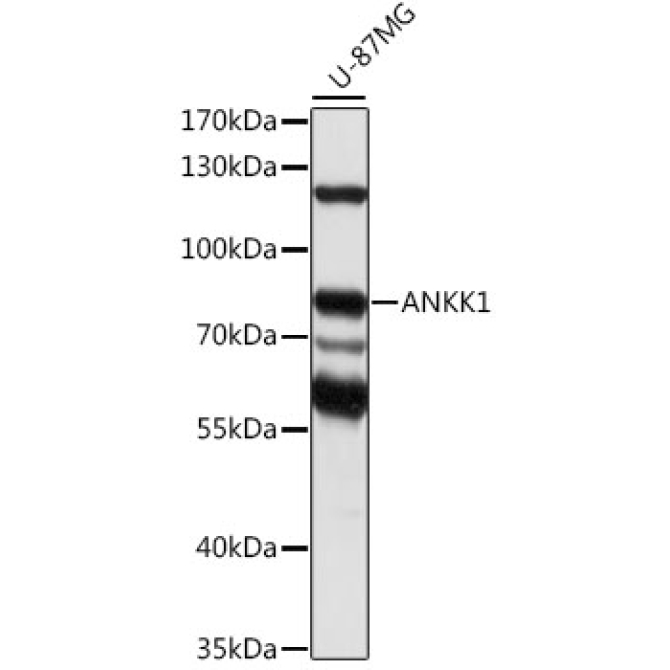 ANKK1 Rabbit Polyclonal Antibody