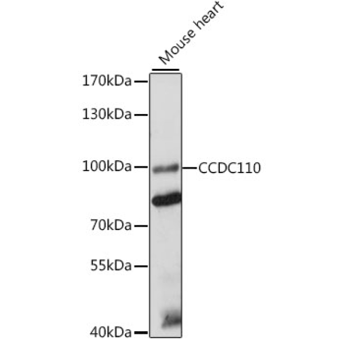 CCDC110 Rabbit Polyclonal Antibody