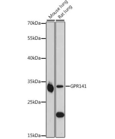 GPR141 Rabbit Polyclonal Antibody