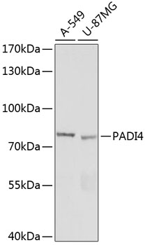 PADI4 Rabbit Polyclonal Antibody