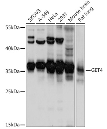 GET4 Rabbit Polyclonal Antibody