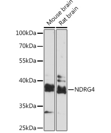 NDRG4 Rabbit Polyclonal Antibody
