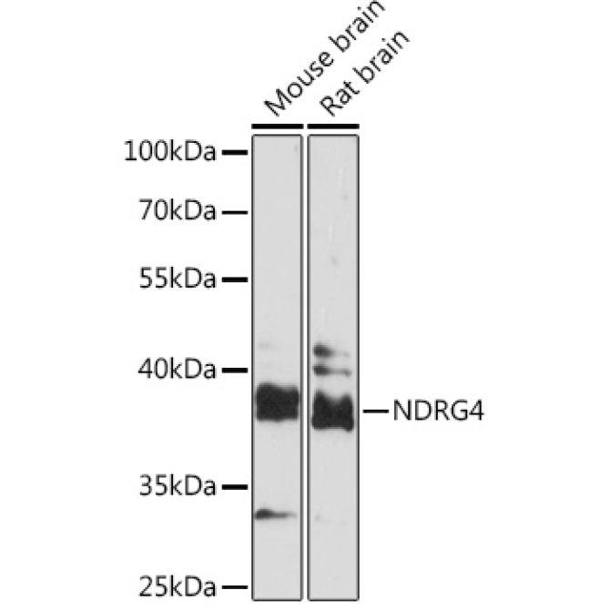 NDRG4 Rabbit Polyclonal Antibody