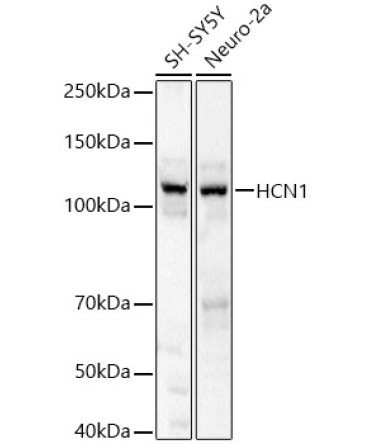 HCN1 Rabbit Polyclonal Antibody