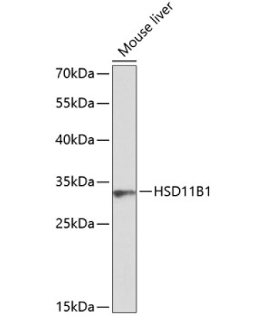 HSD11B1 Rabbit Polyclonal Antibody