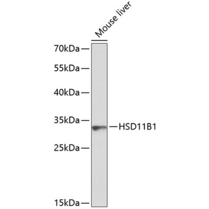 HSD11B1 Rabbit Polyclonal Antibody