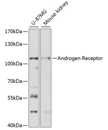 Androgen Receptor Rabbit Polyclonal Antibody