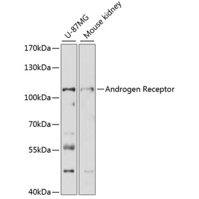 Androgen Receptor Rabbit Polyclonal Antibody