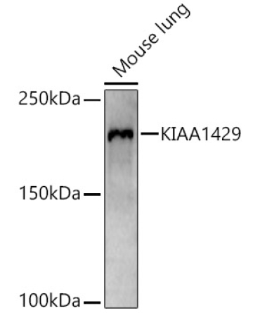 KIAA1429 Rabbit Polyclonal Antibody