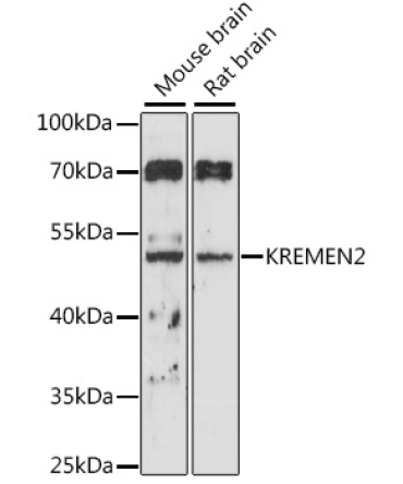 KREMEN2 Rabbit Polyclonal Antibody