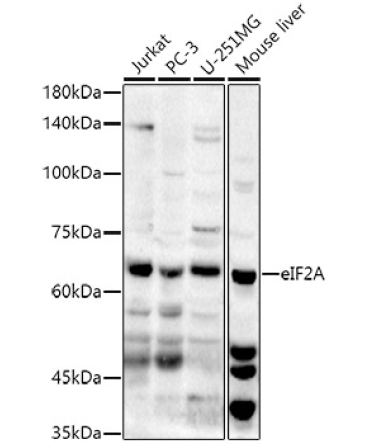 eIF2A Rabbit Polyclonal Antibody