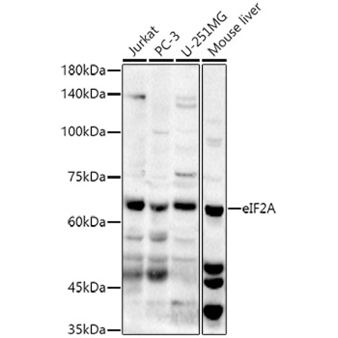 eIF2A Rabbit Polyclonal Antibody
