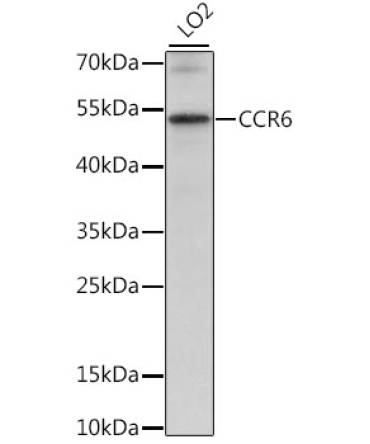 CCR6 Rabbit Polyclonal Antibody